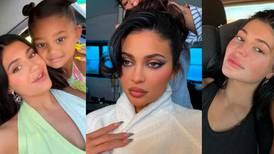 Kylie Jenner habla del cambio en su rostro tras sus embarazos y muchas mamás se identifican