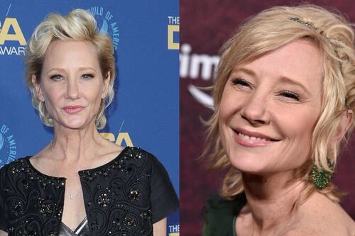 Anne Heche está en coma y no ha recuperado el conocimiento desde el accidente automovilístico