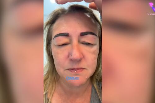 Mujer comparte grave reacción alérgica tras realizarse microblading de cejas