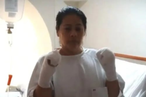 Mujer pierde sus manos en fábrica de Perú y con este monto la quieren indemnizar