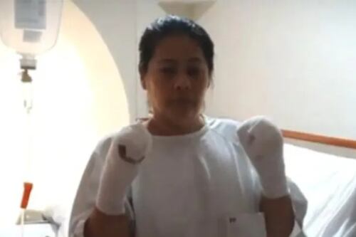 Mujer pierde sus manos en fábrica de Perú y con este monto la quieren indemnizar