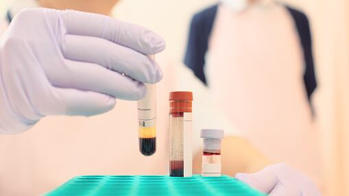 Descubren dos mujeres que tienen la 'sangre dorada' en China