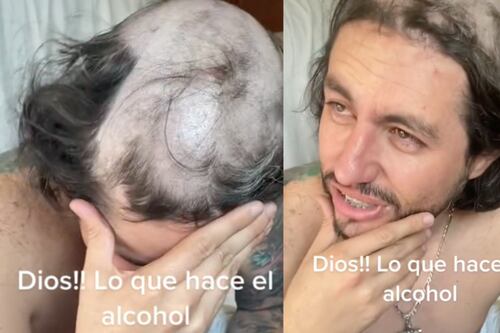 Llegó ebrio a casa y mientras dormía sus hijos lo raparon