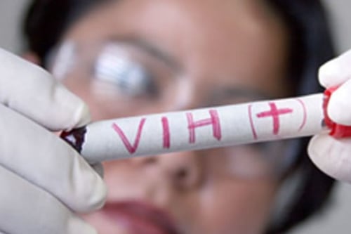 Una adolescente se inyectó sangre de su novio que es VIH positivo como “muestra de amor” 