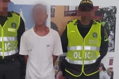 Ladrón se tragó una cadena de oro para evitar ser arrestado