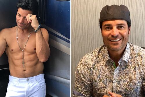 “Se dañó la cara”: Chayanne se hizo ‘arreglitos’ en el rostro y se ganó muchas críticas